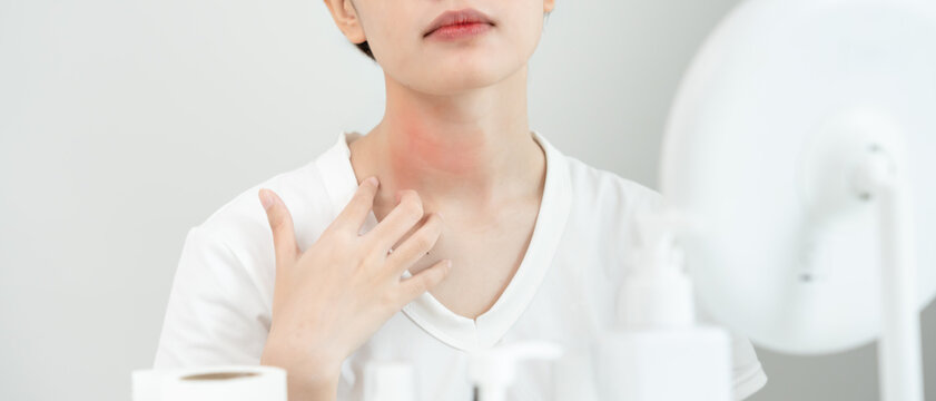 skin problem and beauty. Young woman scratch body has itchy skin from skin allergic, steroid allergy, sensitive skin, red from sunburn, chemical allergy, rash, insect bites, Seborrheic Dermatitis.