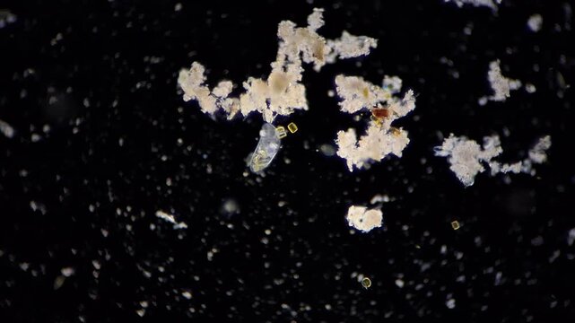 darkfield microscope view of a living ciliate protozoan organism, 100x