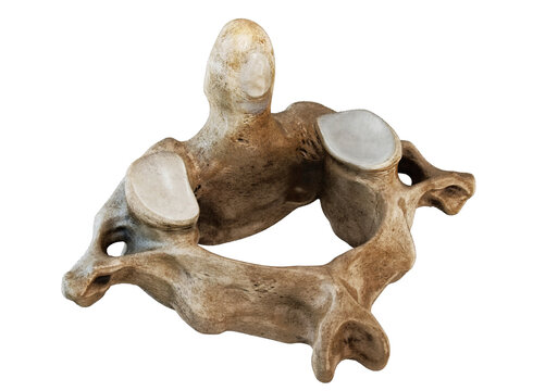 Human cervical vertebra, upper cervical spine, axis C2 anatomy. Anatomical bone model showing vertebral body, superior articular facets and vertebral foramen for medical, orthopedic, educational use