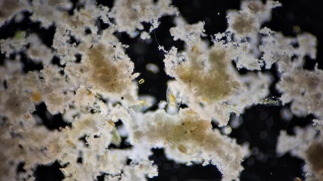 100x darkfield microscope view of a living ciliate protozoan organism