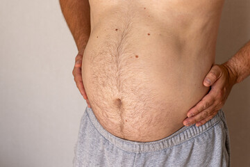 Naklejka premium Close-up of an overweight man's abdomen showing bloating and excess belly fat. Concept of obesity, digestive discomfort, weight gain, health risks and lifestyle.