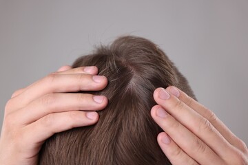 Fototapeta premium Man examining his head on grey background, closeup