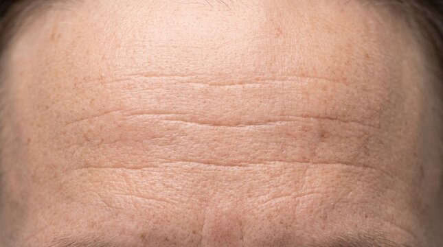 Close up macro shot of forehead skin wrinkles on male face