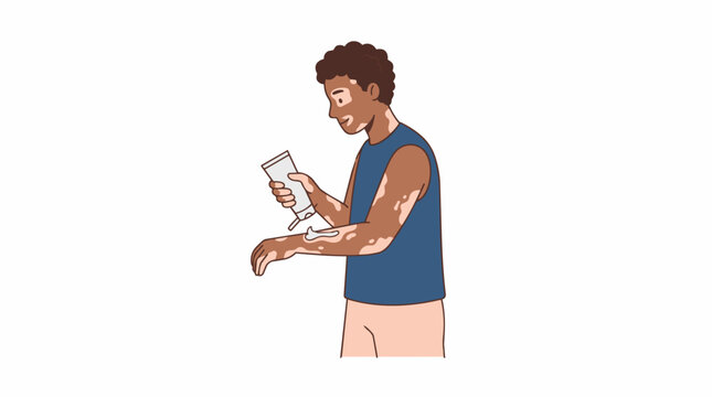 Man with Vitiligo Applying Cream to Skin