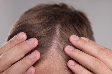 Fototapeta premium Man examining his head on grey background, closeup
