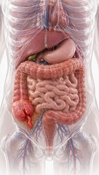 3D Medical Illustration of Human Digestive System with Inflamed Appendix and Internal Organs