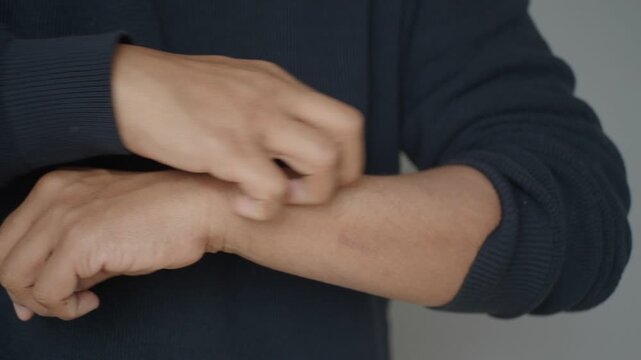 Person scratching arm with noticeable irritation
