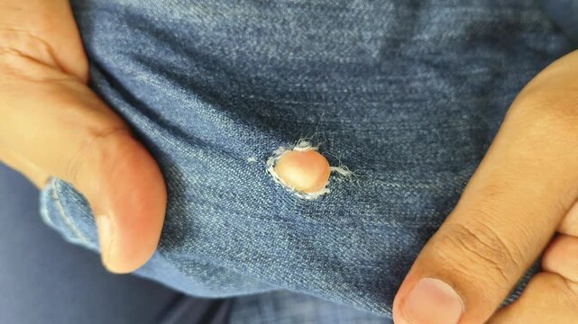 Closeup of tailor hand inspect frayed hole on old blue jeans to do repair maintenance for sustainable reuse. Jean or denim cotton fabric cloth with torn rip damage restoration concept.