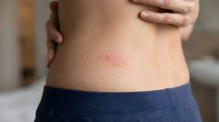 Naklejka premium Close up of skin irritation on abdomen with red rash texture subtle discomfort