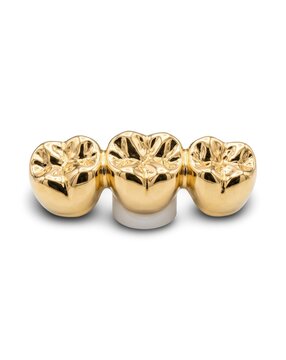 Solid Gold Tooth Crown Bridge Accessory Isolated on White