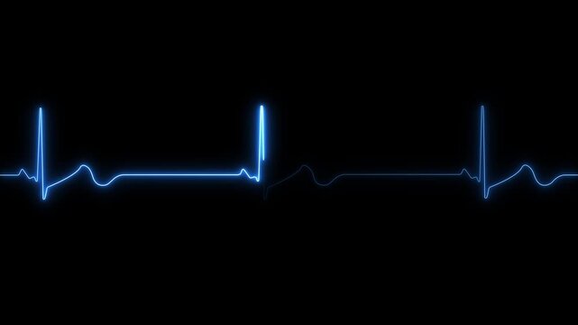 Neon blue ekg heartbeat monitor line loop, medical cardiology pulse rhythm animation on black background