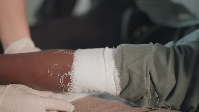 Doctor inspects finished plaster cast on forearm, closeup of hardened white bandage, clean clinic environment, gentle palpation, assessment of healing progress and comfort measures