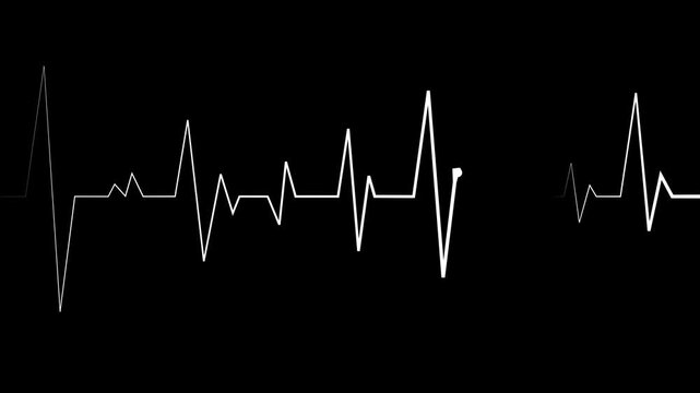Heartbeat line electrocardiogram pulse pattern medical and health concept animation