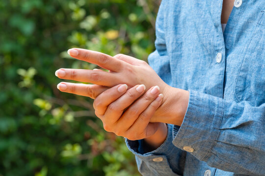 A woman holding their painful hand and numbness, concept of joint pain, injury, or inflammation, highlighting the importance of medical attention, proper care, and orthopedic recovery.	