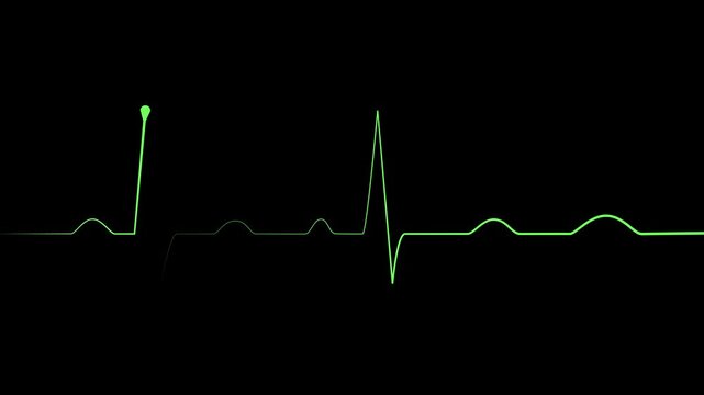 Heartbeat line electrocardiogram style pulse trace with sharp spikes and flat rhythm animation