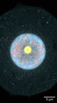 Cell division phase demonstrating condensing chromosome structure, genetic material inside circular nuclear membrane, glowing yellow nucleolus organelle, microscopic biology specimen.