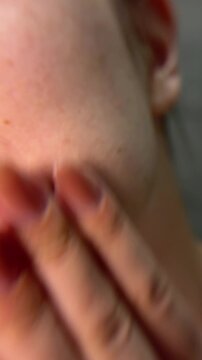 Woman with problem skin applying rejuvenating serum with a pipette. Close up of a skincare routine, moisturizing treatment and anti aging cosmetic therapy for acne