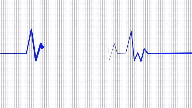 Medical Heartbeat Line Wave Signal Animation with ECG Monitoring Display
