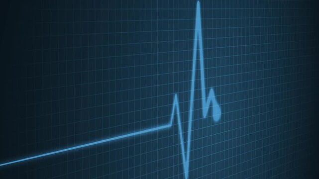 Minimalist Cardiology Healthcare Animation with Pulse Wave Monitoring Signal