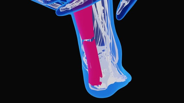 Achilles Tendon Injury and Sports Injury Anatomy Visualization