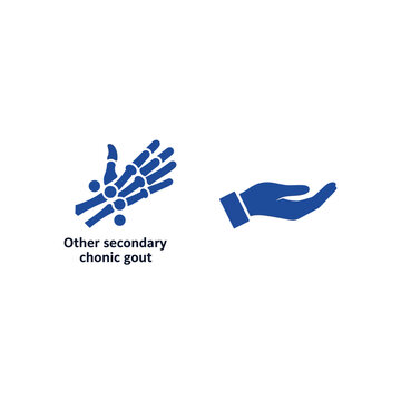 Other secondary chronic gout condition affecting joints and mobility