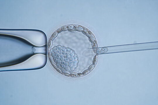 Blastocyst Biopsy Micromanipulation in Reproductive Medicine