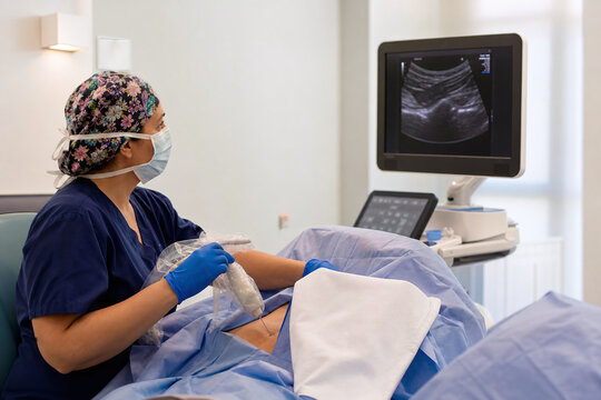 Ultrasound guided egg retrieval in modern fertility clinic