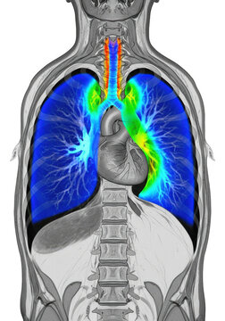 Colored scan of human lungs and trachea