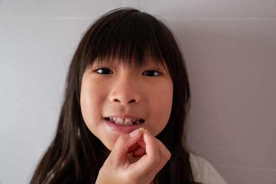 Child Shows Missing Tooth With Smile in Indoor Setting