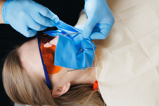 Female dental procedure with protective equipment in use, installing cofferdam for dental filling