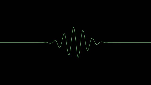 Green oscilloscope heartbeat waveform pulses on a black background representing medical data