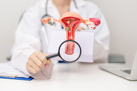 Doctor with Uterus and Ovaries anatomy model. Ovarian and Cervical cancer, Cervix disorder, Endometriosis, Hysterectomy, Uterine fibroids, Reproductive system, Pregnancy and health concept