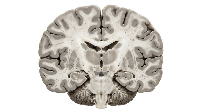 Coronal cross section of real human brain specimen showing internal anatomical structure isolated on white background