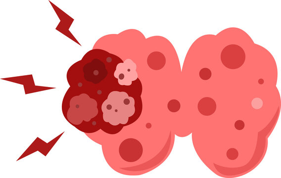 thyroid disease concept. vector illustration