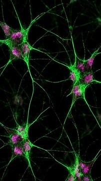 Human brain neurons activity 
