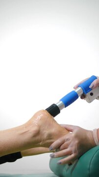 Medical shockwave therapy device applying acoustic waves to patient moist heel. Professional physiotherapy treatment for plantar fasciitis and pain relief in clean white clinical setting 4k video