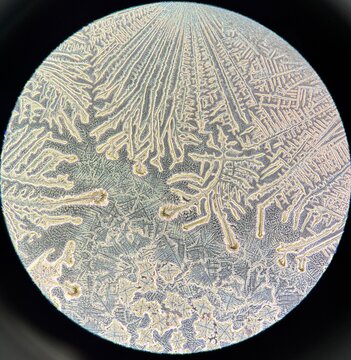 a crystallization of culture media under the inverted microscope 