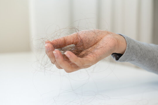 Hair fall problem concept. Shocked Asian woman looking at many hair lost in her hand and comb.