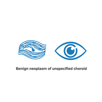 Medical illustration of eye choroid condition with text