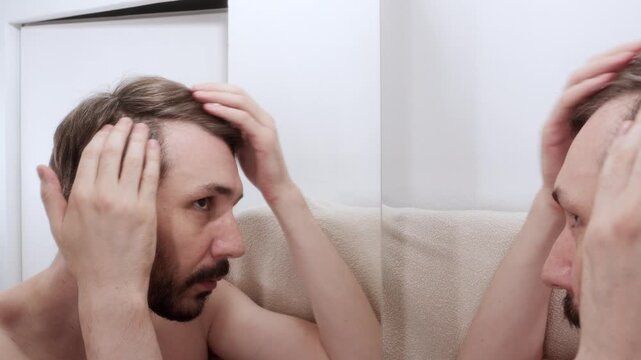Man checking his receding hairline in the mirror, touching his hair and scalp to assess their condition