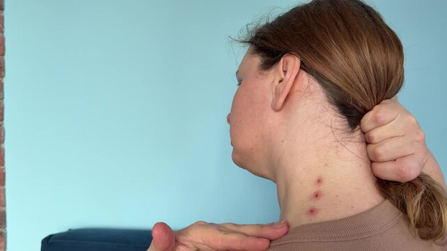 Close up profile of a woman demonstrating allergic reaction symptoms with small red bumps on her neck