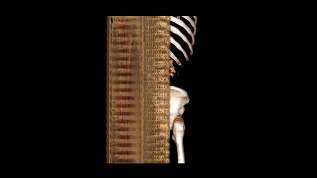 3D CT Scan Rotation of Spine Pelvis Ribs and Urinary Bladder