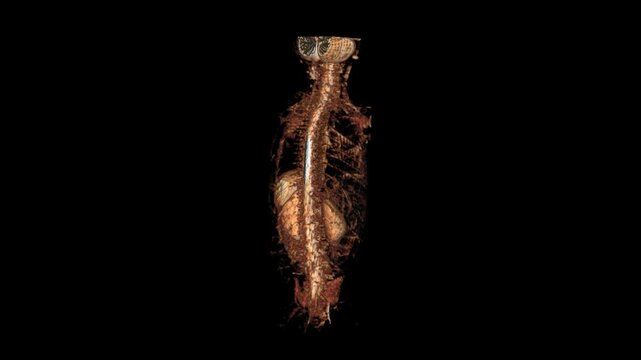 Full Spine and Torso Vascular Volume Rendering