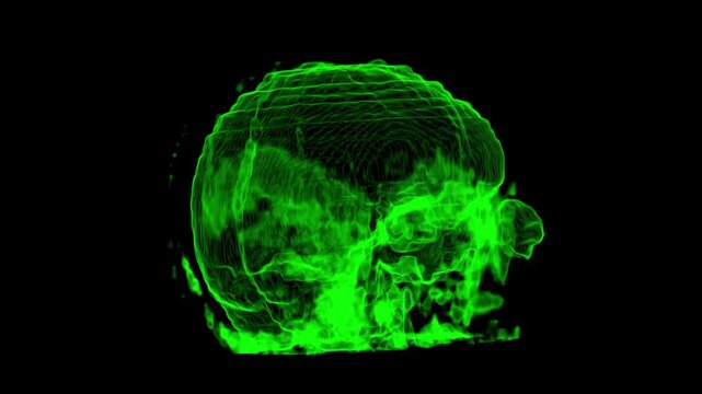 3D CT Scan Rotating View of Cranial Mesh and Skull Contour