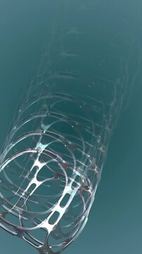 Coronary artery stent deployment medical animation