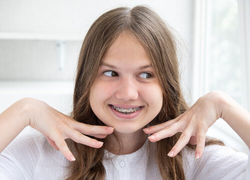 Happy positive joyful girl smiling showing teeth with dental braces. Funny teenager with brackets