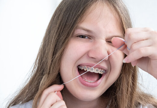 Happy teen girl with braces cleaning teeth using dental floss. Dental hygiene during orthodontic treatment