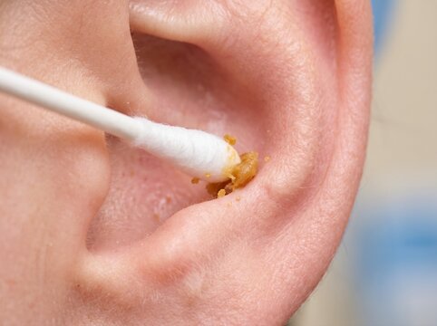 A close-up view of a cotton swab being used to remove wax from the inner fold of a person's ear.