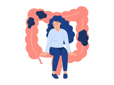 Woman with Large Colon Illustration Depicting Colorectal Cancer and Digestive Disease
