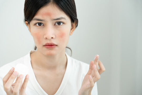 Skin and beauty problems Women have itchy skin and red rashes from cosmetic allergies, steroid allergies, sensitive skin, redness from sunlight, chemical allergies, rashes, insect bites.